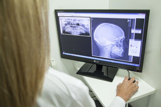 jaw xray for jaw surgery