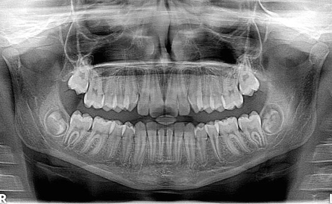 dental xray