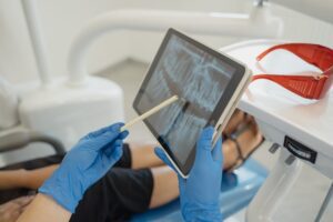 dental professional with xray of mouth on tablet