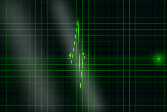electrocardiogram